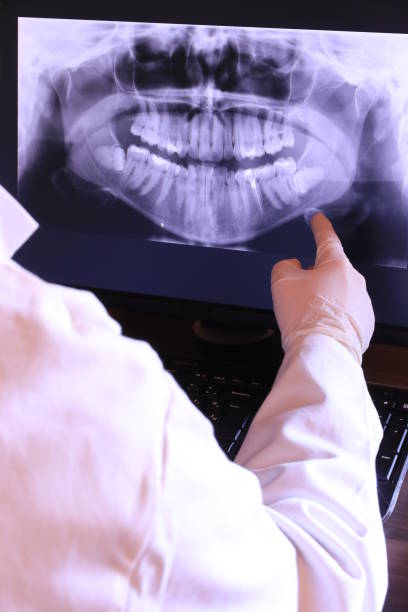 Best Dental Abscess Treatment in Harper, KS