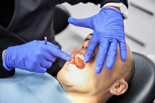 Best Knocked-Out Tooth (Avulsed Tooth) Treatment in Harper, KS