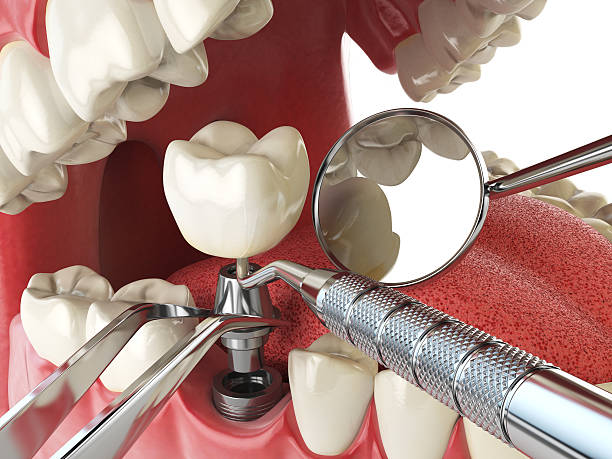 Best Urgent Dental Care for Toothaches in Harper, KS